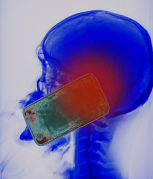 Colour X-ray showing the head of a man using a smartphone &copy; VOISIN/PHANIE/SCIENCE PHOTO LIBRARY